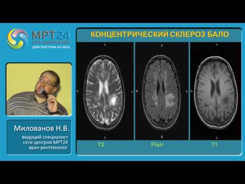 Боли ниже поясницы причина Черный тмин при остеохондроз