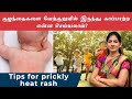 கோடையில் குழந்தைகளை வியர்க்குருவில�