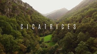 Cicatrices | LA ZONA