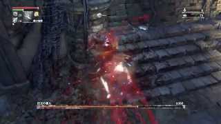 ブラッドボーン 聖杯ダンジョン 旧主の番人攻略 がチーターに Ww تحميل اغاني مجانا