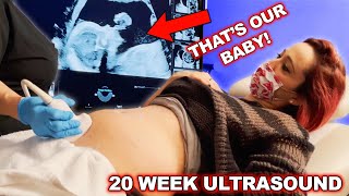 20 Week Pregnancy Anatomy Scan - 3D Ultrasound!