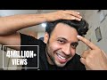 HOW I STOPPED MY HAIR FALL क्या आपके बाल झड़ते है ज़रू�