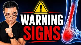 5 Warning Signs of Achilles Pain (And How to Treat It Early)