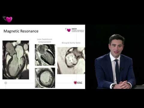 EACVI free webinar: How to use imaging for transcatheter interventions? (II)