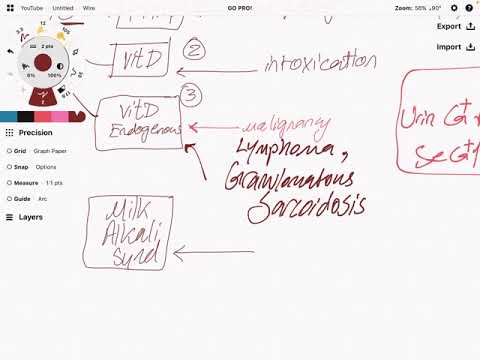 Approach to Hypercalcemia-1