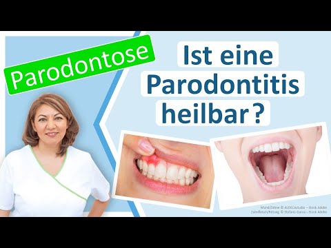 Parodontose: Lässt sich eine Parodontitis stoppen oder sogar heilen? Zahnarzt Großostheim, N. Redjai