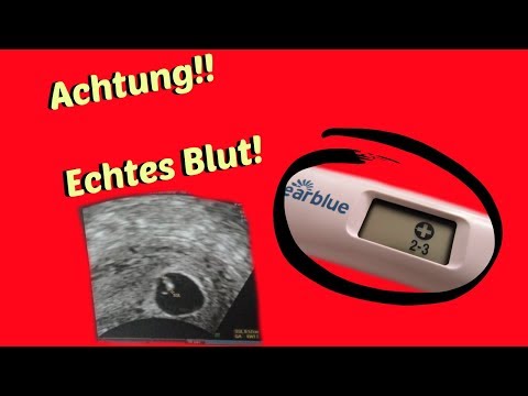 Übung für die Behandlung von Lenden- Chondrose Was tun, um nicht wieder das Geld anderer Leute zu verletzen