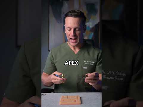 The Corner stitch, for v-shaped, y-shaped or stellate lacerations #stitches #suturing #surgery