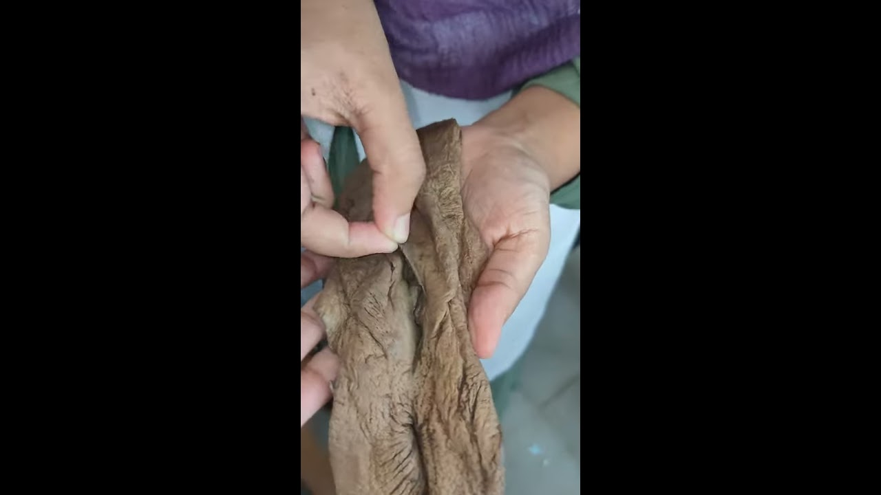 Watch video Vagina Female External Genitalia Now Vagina Female External Genitalia