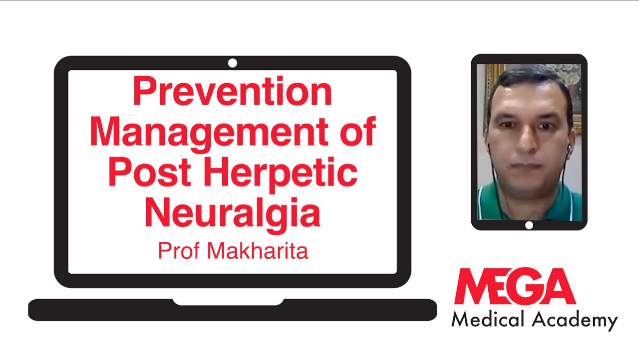 Prevention and Management of Post-herpetic Neuralgia