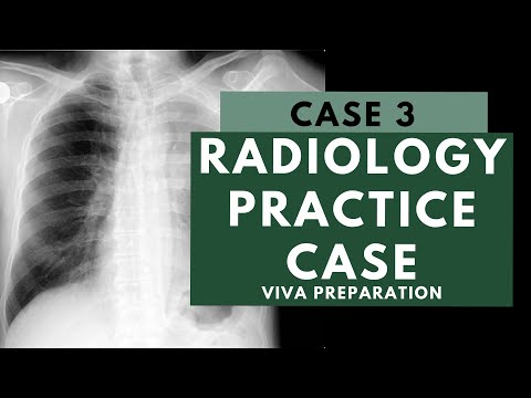 Radiology Viva Practice Case: 3 - FRCR 2B preparation