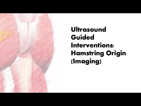 #ultrasound Guided Interventions: Hamstring Origin (Imaging) #fyp #sport #sports #sportsmedicine