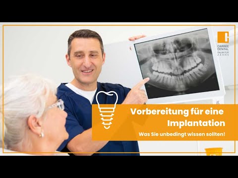 Vorbereitung für eine Implantation: Was Sie unbedingt wissen sollten | Carree Dental