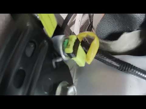 アナ・ポーラ・シーベルトさんはIUDで子宮に穴を開け、手術を受ける