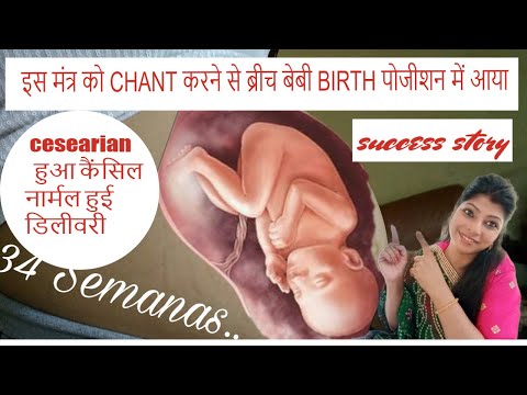 sucess story of turning breech baby with powerful mantra|how to turn breech baby|without excercise