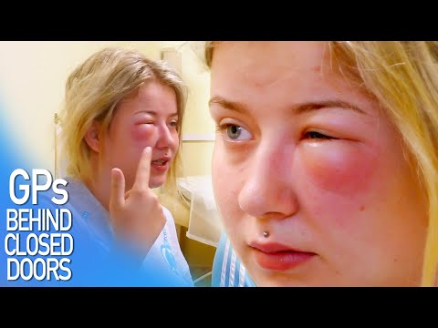 Swollen Eye From Wasp Sting | FULL EPISODE S04E11 | GPs: Behind Closed Doors