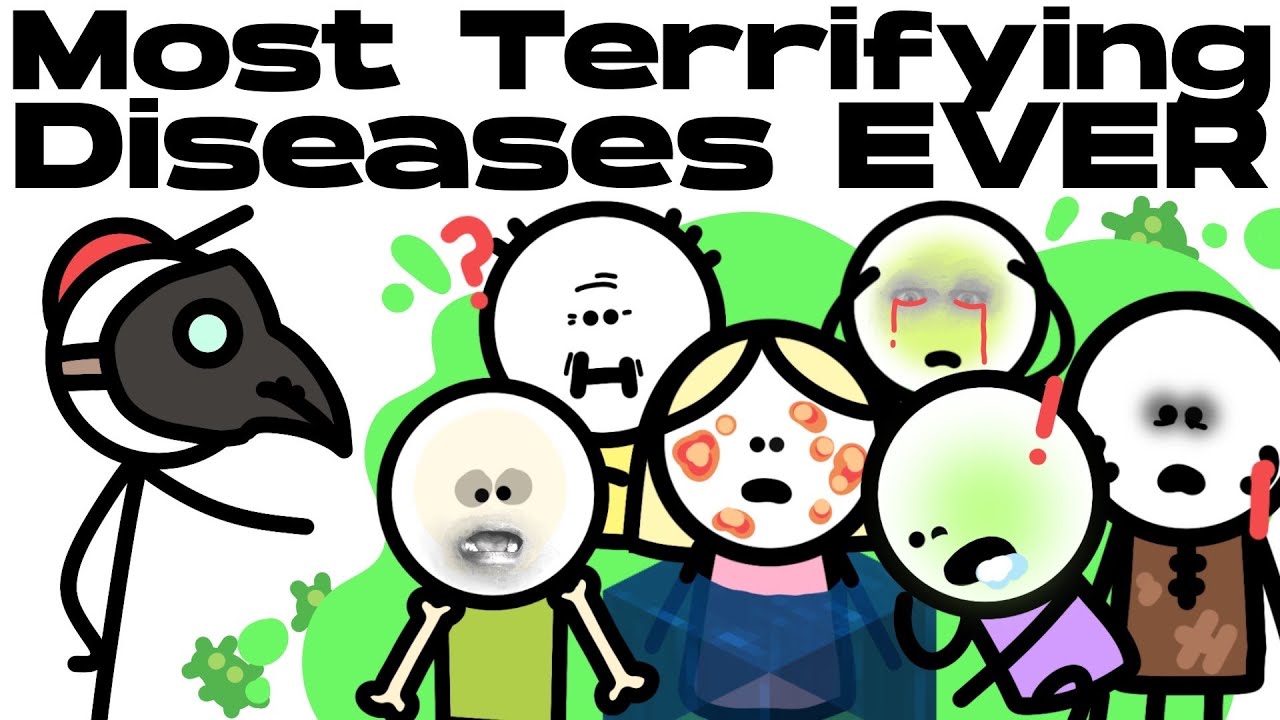 Terrifying Diseases That Will Kill You..