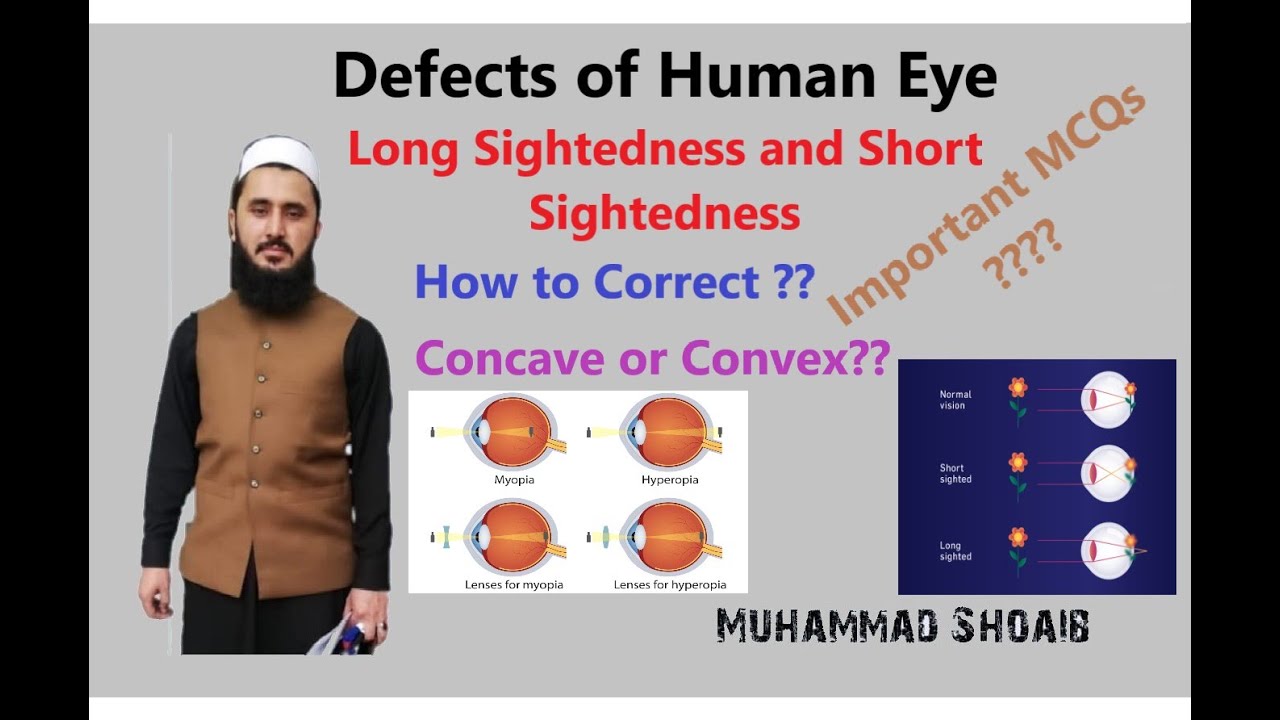 Short Sightedness and Long Sightedness
