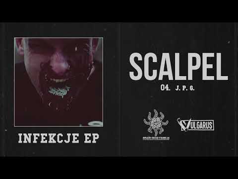 Scalpel - [04/08] - J.P.G. (OFICJALNY ODSŁUCH)