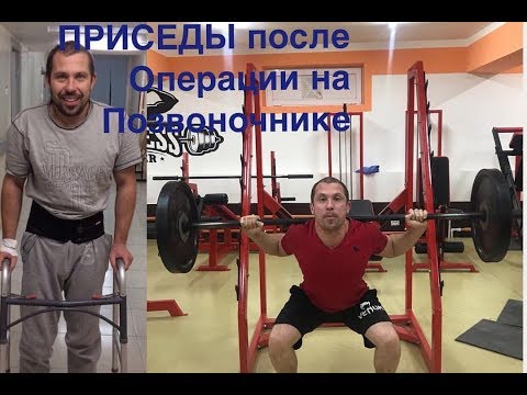 Лекарство коленный сустав Хруст в грудном отделе позвоночника