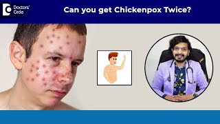 Can you get CHICKENPOX Twice| Chickenpox Vaccine & Treatment -Dr.Leela Mohan P V R |Doctors' Circle