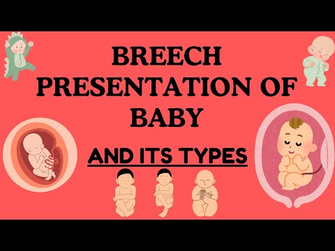 Breeching