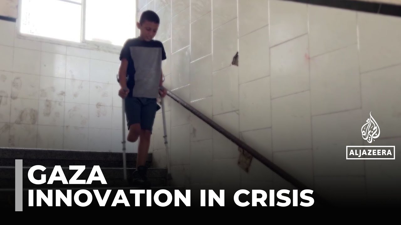 Physical scars of war: health ministry reports 6,000 amputations