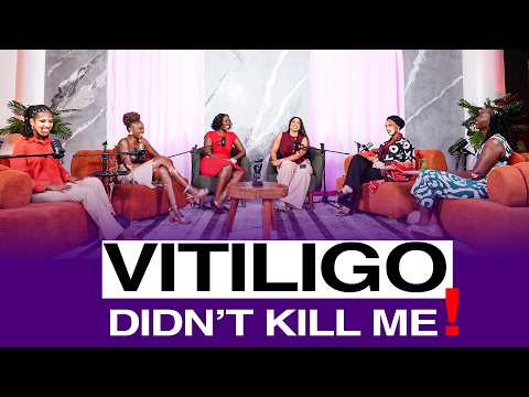 VITILIGO