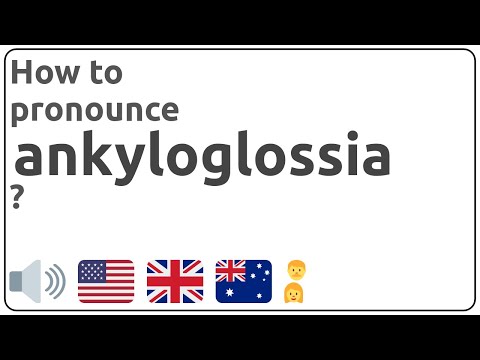 How to pronounce ankyloglossia in english?