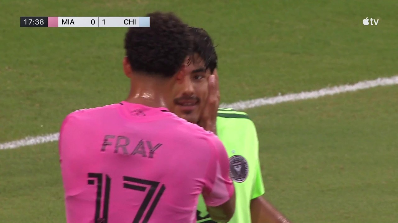 😱🔥 ERROR Y AUTOGOL Rocco Ríos Novo | Inter Miami 1-0 Chicago Fire | MLS 2026