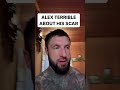 ALEX TERRIBLE ABOUT HIS SCAR