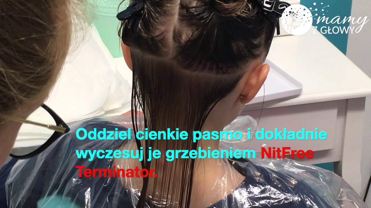 ZWALCZANIE WSZAWICY W PRAKTYCE - jak skutecznie usunąć wszy i gnidy - najlepsza instrukcja!