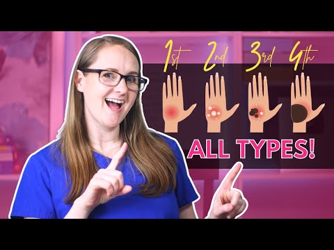 Degree of Burns (1st, 2nd, 3rd, 4th Degree Burn Breakdown)