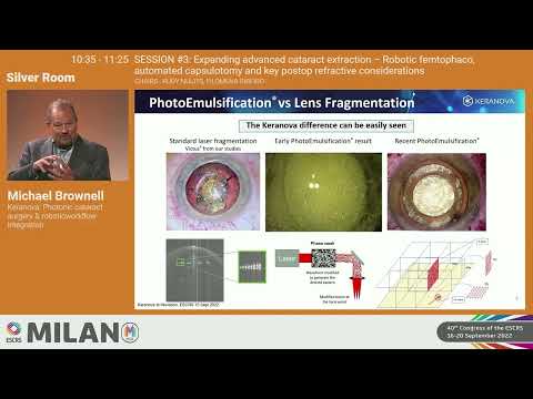 Emerging Company Showcase Presentations from ESCRS iNovation® Day 2022 | KERANOVA: Michael Brownell