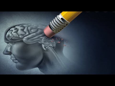 ALZHEIMER  MM 23 03 22-