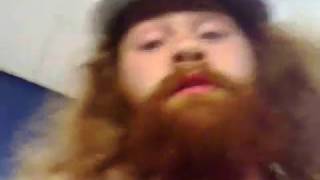 Frase shaves his head for charity