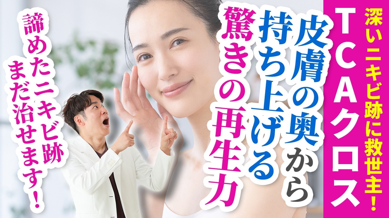 【TCAクロス(ニキビ跡治療)】ボックス型、アイスピック型の凹み、水疱瘡後の凹みを盛り上げる!TCAクロスの仕組みとダウンタイム、セルフTCAの危険性を皮膚科専門医が解説