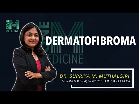 Chapter 55-D | Dermatofibroma | Dermatology | OneMedicine