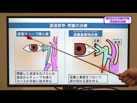 看護学科 20241214 『流涙症の治療』 眼科：宮下 久範 助教