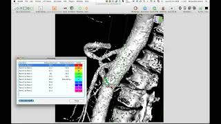 Surface Length Plugin