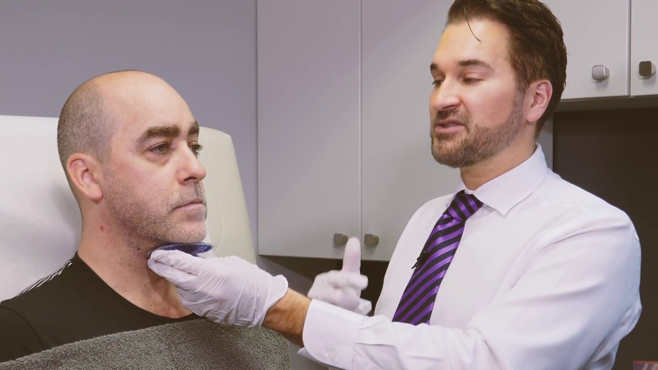 Belkyra – Traitement du double-menton sans chirurgie