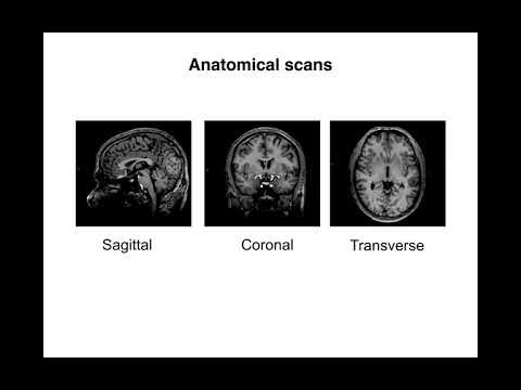 functional MRI basics part 1