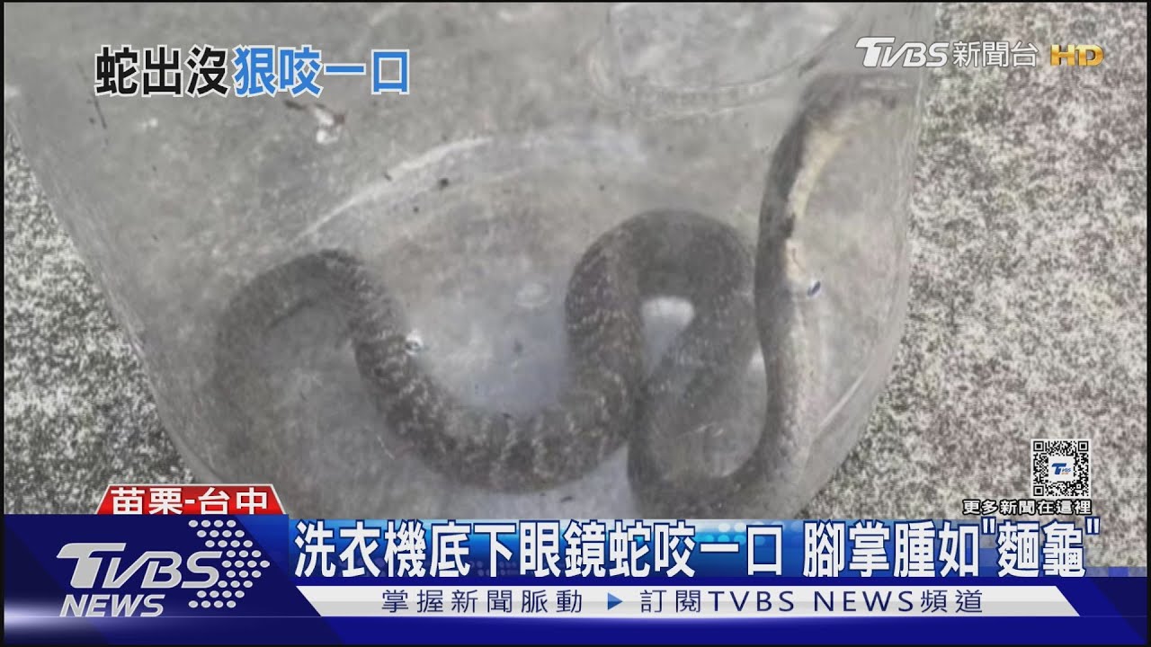 洗衣機底下眼鏡蛇咬一口 腳掌腫如「麵龜」