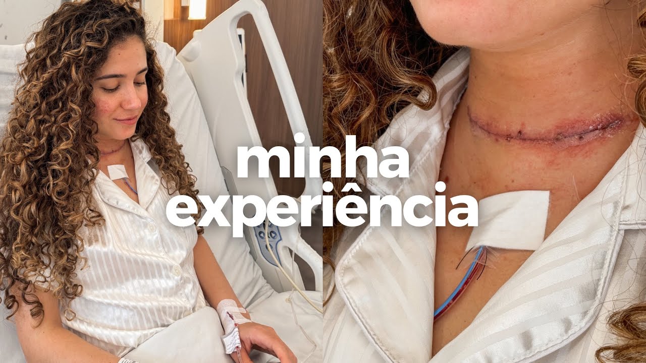 Tive câncer de tireoide com metástase aos 28 anos