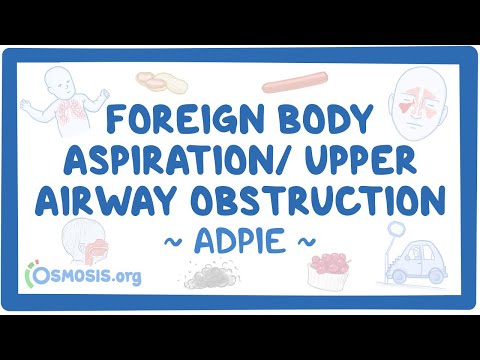 Chronic obstructive pulmonary disease Nursing Process