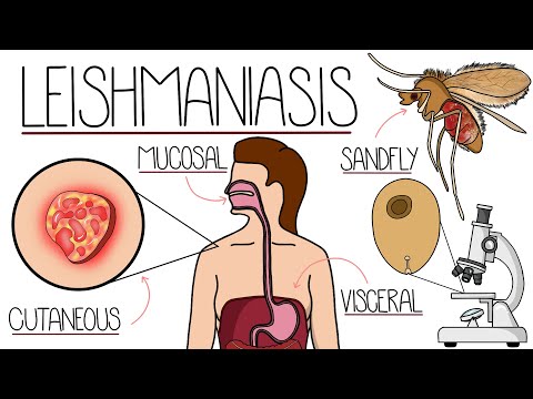 Leishmaniose klar erklärt