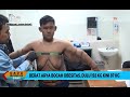 Berat Badan Turun Lebih Dari 100 Kg, Arya Permana Akan Operasi Plastik Untuk Buang Kulit Gelambir