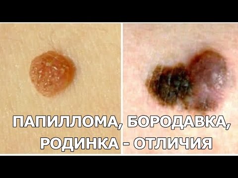 Отбеливание лица в Как избавиться от веснушек эффективные средства