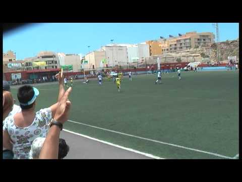 CHUS tenerife 280511.