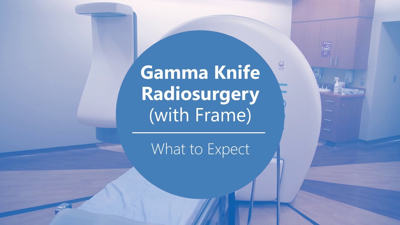 What to Expect When Having Gamma Knife Radiosurgery (with the frame)